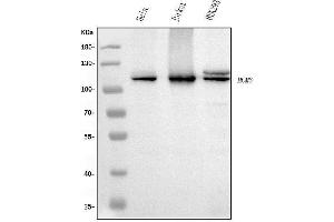 Western blot analysis of MCM6 using anti-MCM6 antibody (ABIN7600036). (MCM6 Antikörper  (AA 14-821))