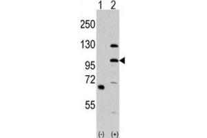 Western Blotting (WB) image for anti-Mitogen-Activated Protein Kinase Kinase Kinase MLK4 (KIAA1804) antibody (ABIN3003622)