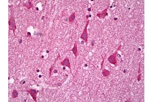 Anti-GUCY1B3 / Guanylyl Cyclase Beta 1 antibody IHC of human brain, cortex neurons. (GUCY1B3 Antikörper)