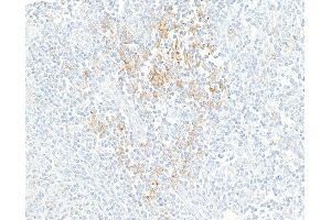 Immunohistochemistry (IHC) image for anti-CD274 (PD-L1) (C-Term) antibody (ABIN7454042) (Rekombinanter PD-L1 Antikörper  (C-Term))