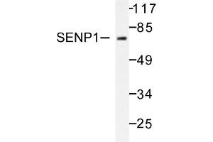 Image no. 1 for anti-SUMO1/sentrin Specific Peptidase 1 (SENP1) antibody (ABIN271955) (SENP1 Antikörper)