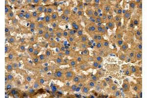 ABIN6257369 and ABIN6275406 at 1/100 staining Rat liver tissue by IHC-P.