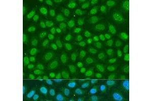 Immunofluorescence analysis of U2OS cells using TAF11 Polyclonal Antibody at dilution of 1:100. (TAF11 Antikörper)