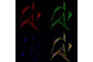 ABIN6259350 and ABIN6275567 staining 3 by IF/ICC. (SH3GLB2 Antikörper  (C-Term))