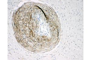 Anti-Calponin antibody, IHC(P) IHC(P): Human Placenta Tissue (CNN1 Antikörper  (C-Term))