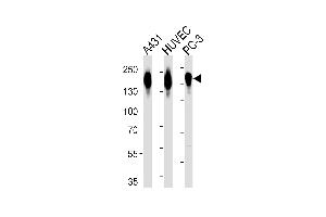 Western blot analysis of lysates from A431, HUVEC, PC-3 cell line (from left to right), using EGFR Antibody (p) (ABIN651628 and ABIN2840334).