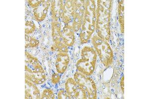 Immunohistochemistry of paraffin-embedded Mouse kidney using Parkin antibody  at dilution of 1:100 (40x lens). (Parkin Antikörper  (AA 1-300))