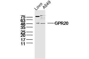Lane 1: LOVO lysates Lane 2: A549 lysates probed with GPR20 Polyclonal Antibody, Unconjugated  at 1:300 dilution and 4˚C overnight incubation. (GPR20 Antikörper  (AA 51-150))
