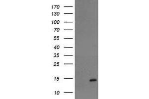 Image no. 1 for anti-TP53RK Binding Protein (TPRKB) antibody (ABIN1501485) (TPRKB Antikörper)