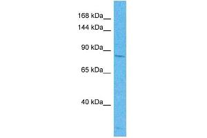 Host:  Rabbit  Target Name:  ZMYND8  Sample Type:  Thymus Tumor lysates  Antibody Dilution:  1. (ZMYND8 Antikörper  (C-Term))