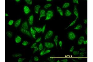 Immunofluorescence of monoclonal antibody to NCOA4 on HeLa cell. (NCOA4 Antikörper  (AA 505-614))