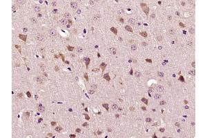 Paraformaldehyde-fixed, paraffin embedded Mouse brain Antigen retrieval by boiling in sodium citrate buffer (pH6.