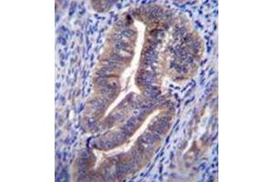Immunohistochemistry (Paraffin-embedded Sections) (IHC (p)) image for anti-Endosome/Lysosome-associated Apoptosis and Autophagy Regulator 1 (ELAPOR1) (AA 703-732), (C-Term) antibody (ABIN953056)