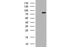 Image no. 2 for anti-Polymerase (DNA Directed) iota (POLI) (AA 458-740) antibody (ABIN1491524)