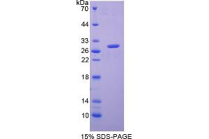 Image no. 1 for Glutathione S-Transferase alpha 2 (GSTa2) (AA 1-222) protein (His tag) (ABIN4988944)
