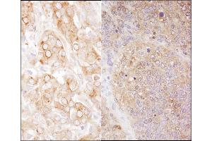 Immunohistochemistry (IHC) image for anti-Eukaryotic Translation Elongation Factor 2 (EEF2) (AA 808-858) antibody (ABIN7454538) (EEF2 Antikörper  (AA 808-858))