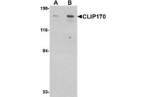 Western blot analysis of CLIP170 in rat brain tissue lysate with AP30238PU-N CLIP170 antibody at (A) 0.