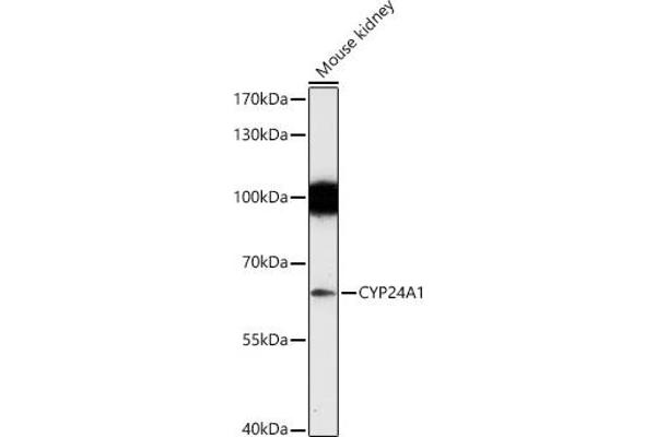 CYP24A1 Antikörper  (AA 36-448)