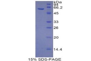 SDS-PAGE analysis of Rat Reprimo Protein.
