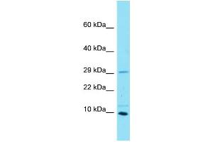 Host: Rabbit Target Name: C16orf55 Sample Type: MCF7 Whole Cell lysates Antibody Dilution: 1.