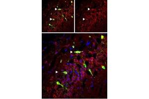 Expression of mGluR5 in rat hippocampus - Immunohistochemical staining of perfusion-fixed frozen rat hippocampus sections using Anti-mGluR5 (extracellular) Antibody (ABIN7043250, ABIN7044332 and ABIN7044333), (1:50). (Metabotropic Glutamate Receptor 5 Antikörper  (Extracellular))