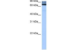 WB Suggested Anti-ADAD2 Antibody Titration:  0. (ADAD2 Antikörper  (Middle Region))