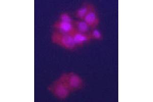 Immunofluorecence staining of GPC3 polyclonal antibody  on HepG2 cells . (Glypican 3 Antikörper  (N-Term))