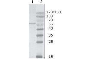 Western Blot testing of HIV-1 Gag p17/24 using HIV-1 p24 antibody, clone N13 (05-006).