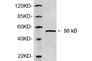 Western blot analysis of recombinant human AP2M1 protein using 1 µg/mL Rabbit Anti-AP2M1 Polyclonal Antibody (ABIN398781) The signal was developed with IRDyeTM 800 Conjugated Goat Anti-Rabbit IgG. (AP2M1 Antikörper  (N-Term))