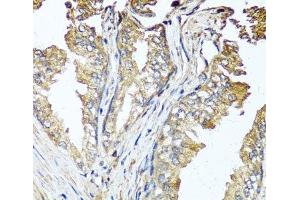 Immunohistochemistry of paraffin-embedded Human prostate using STK3 Polyclonal Antibody at dilution of 1:100 (40x lens).