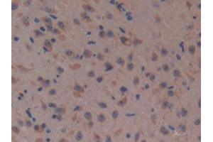 DAB staining on IHC-P; Samples: Mouse Brain Tissue (Complement Factor H Antikörper  (AA 915-1156))
