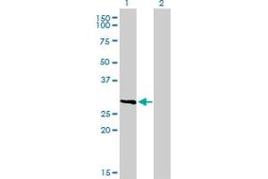 Western Blot analysis of FCER1A expression in transfected 293T cell line by FCER1A monoclonal antibody (M01), clone 2C12-3B6. (Fc epsilon RI/FCER1A Antikörper  (AA 1-257))