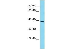 Host: Rabbit Target Name: OR11A1 Sample Type: HT1080 Whole Cell Lysate lysates Antibody Dilution: 1. (OR11A1 Antikörper  (C-Term))