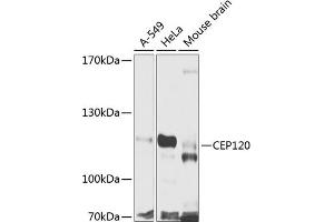 Western blot analysis of extracts of various cell lines, using CEP120 antibody (ABIN6133305, ABIN6138415, ABIN6138416 and ABIN6224025) at 1:1000 dilution. (CEP120 Antikörper  (AA 1-270))