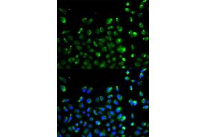 Immunofluorescence analysis of A549 cell using ATG13 antibody. (ATG13 Antikörper  (AA 281-480))