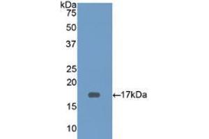 Western blot analysis of recombinant Human CD3d. (CD3D Antikörper  (AA 18-113))