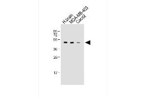 All lanes : Anti-KCNJ13 Antibody (N-term) at 1:2000 dilution Lane 1: Human brain whole tissue lysate Lane 2: MDA-MB-453 whole cell lysate Lane 3: Caco2 whole cell lysate Lysates/proteins at 20 μg per lane. (KCNJ13 Antikörper  (N-Term))