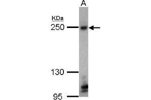 WB Image Sample (30 ug of whole cell lysate) (TJP1 Antikörper  (C-Term))