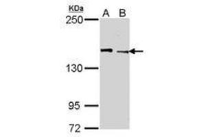 Image no. 1 for anti-Lysine (K)-Specific Demethylase 5C (KDM5C) (AA 10-261) antibody (ABIN467524) (KDM5C Antikörper  (AA 10-261))