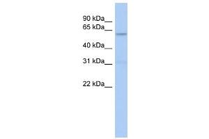 CAMKII antibody used at 1 ug/ml to detect target protein. (CAMKII gamma Antikörper  (N-Term))