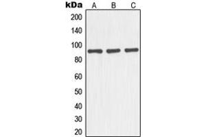 Western blot analysis of NOC3L expression in HEK293T (A), mouse liver (B), rat kidney (C) whole cell lysates. (NOC3L Antikörper  (Center))