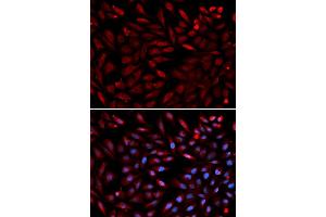 Immunofluorescence analysis of U2OS cells using PSMC2 antibody. (PSMC2 Antikörper)