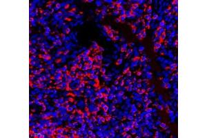 Immunofluorescence of paraffin embedded human tonsil using septin1 (ABIN7074453) at dilution of 1: 650 (400x lens) (LARP1 Antikörper)