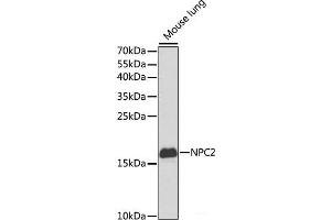 Western blot analysis of extracts of Mouse lung using NPC2 Polyclonal Antibody at dilution of 1:1000. (NPC2 Antikörper)