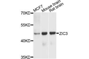 Western blot analysis of extracts of various cells, using ZIC3 antibody. (ZIC3 Antikörper)