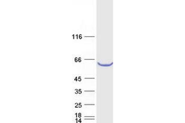 TBC1D24 Protein (Myc-DYKDDDDK Tag)