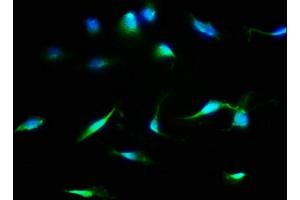 Immunofluorescence staining of U251 cells with ABIN7158941 at 1:133, counter-stained with DAPI. (MDH1 Antikörper  (AA 1-334))