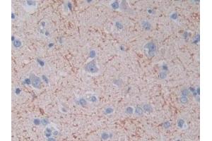 Detection of TOP3 in Human Cerebrum Tissue using Polyclonal Antibody to Topoisomerase III (TOP3)