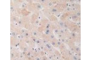 Detection of DRD1 in Human Liver Tissue using Polyclonal Antibody to Dopamine Receptor D1 (DRD1) (Dopamine Receptor d1 Antikörper  (AA 338-446))