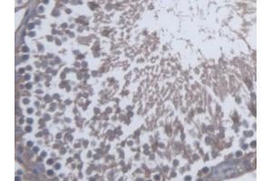 DAB staining on IHC-P; Samples: Rat Testis Tissue (SKAP1 Antikörper  (AA 1-354))